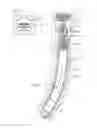 Fig. 06 - APPARATUS, SYSTEM AND METHOD FOR MATERIAL EXTRACTION IN UNDERGROUND HARD ROCK MINING