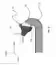 Fig. 10 - NOZZLE FOR FOAM WASHING OF JET ENGINE