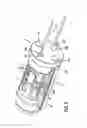 Fig. 03 - Sensor module for a pressure-measuring sheathed-element glow plug