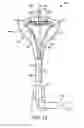 Fig. 15 - WIND-ENERGY CONVERSION SYSTEM AND METHODS APPARATUS AND METHOD