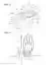 Fig. 04 - Pendulum damper device and lock-up device for torque converter