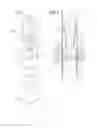 Fig. 02 - Solenoid Valve And Refrigeration Machine Which Uses Same