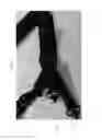 Fig. 06 - FIREARM SHOULDER HARNESS