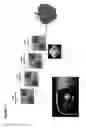 Fig. 12 - Sensor-synchronized spectrally-structured-light imaging