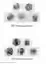 Fig. 10 - Sheath fluid systems and methods for particle analysis in blood samples