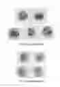 Fig. 11 - Sheath fluid systems and methods for particle analysis in blood samples