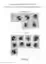 Fig. 18 - Sheath fluid systems and methods for particle analysis in blood samples