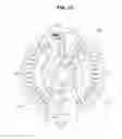 Fig. 19 - Microfluidic device and method of detecting sample supplied to the same