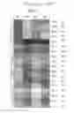 Fig. 08 - ASSAY FOR SCREENING COMPOUNDS THAT SELECTIVELY DECREASE THE NUMBER OF CANCER STEM CELLS