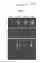 Fig. 13 - ASSAY FOR SCREENING COMPOUNDS THAT SELECTIVELY DECREASE THE NUMBER OF CANCER STEM CELLS