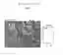 Fig. 30 - ASSAY FOR SCREENING COMPOUNDS THAT SELECTIVELY DECREASE THE NUMBER OF CANCER STEM CELLS