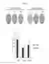 Fig. 33 - ASSAY FOR SCREENING COMPOUNDS THAT SELECTIVELY DECREASE THE NUMBER OF CANCER STEM CELLS