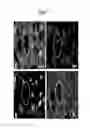 Fig. 43 - ASSAY FOR SCREENING COMPOUNDS THAT SELECTIVELY DECREASE THE NUMBER OF CANCER STEM CELLS