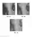 Fig. 06 - Antibody conjugates