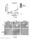 Fig. 02 - COMPOSITIONS AND METHODS FOR IDENTIFYING A RISK OF CANCER IN A SUBJECT