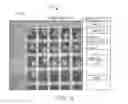 Fig. 18 - Apparatus, Method, and System for the Automated Imaging and Evaluation of Embryos, Oocytes and Stem Cells