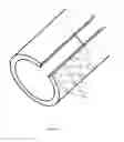 Fig. 20 - Coil assembly for magnetic resonance imaging