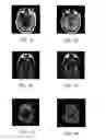 Fig. 09 - Method and apparatus for using B1 map to correct intensity of magnetic resonance images