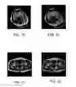 Fig. 10 - Method and apparatus for using B1 map to correct intensity of magnetic resonance images