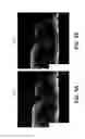 Fig. 06 - Magnetic resonance image reconstruction for undersampled data acquisitions