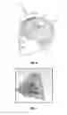 Fig. 07 - Ultrasonic adaptive beamforming method and its application for transcranial imaging