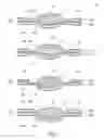 Fig. 08 - Optical structure with ridges arranged at the same and method for producing the same