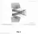 Fig. 07 - TELEPHOTO LENS SYSTEM