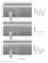 Fig. 29 - Differential transmission for reduction of cross-talk in projective capacitive touch sensors