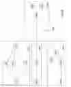 Fig. 06 - Dynamic reduction of stream backpressure