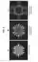 Fig. 07 - Rotavirus particles with chimeric surface proteins
