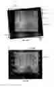 Fig. 11 - UNIVERSAL ASSAY READER