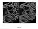 Fig. 33 - Systems and methods for segmentation and processing of tissue images and feature extraction from same for treating, diagnosing, or predicting medical conditions