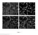 Fig. 45 - Systems and methods for segmentation and processing of tissue images and feature extraction from same for treating, diagnosing, or predicting medical conditions