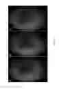 Fig. 07 - BIOMETRIC IDENTIFICATION VIA RETINA SCANNING