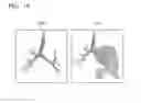 Fig. 11 - Method for extracting airways and pulmonary lobes and apparatus therefor