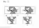 Fig. 12 - Method for extracting airways and pulmonary lobes and apparatus therefor