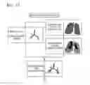 Fig. 15 - Method for extracting airways and pulmonary lobes and apparatus therefor