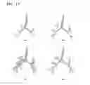Fig. 18 - Method for extracting airways and pulmonary lobes and apparatus therefor