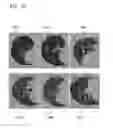 Fig. 26 - Method for extracting airways and pulmonary lobes and apparatus therefor