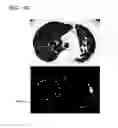 Fig. 31 - Method for extracting airways and pulmonary lobes and apparatus therefor