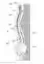 Fig. 01 - Spinal injection trainer and methods therefor