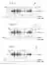 Fig. 04 - System and method for enhancing speech activity detection using facial feature detection