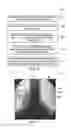 Fig. 05 - X-ray imaging system and method with a real-time controllable 3D X-ray attenuator