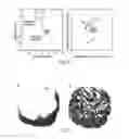 Fig. 06 - Electron microscopy sample support including porous metal foil