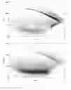 Fig. 12 - Compact particle sensor