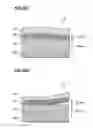 Fig. 12 - Film forming method
