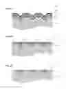 Fig. 04 - Systems and methods for producing flat surfaces in interconnect structures