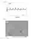 Fig. 20 - NANOFIBER WEB PIEZOELECTRIC MATERIAL OBTAINED BY ELECTROSPINNING
POLYLACTIC ACID, METHOD OF PRODUCING SAME, PIEZOELECTRIC SENSOR COMPRISING SAME, AND METHOD OF MANUFACTURING THE PIEZOELECTRIC SENSOR