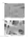 Fig. 21 - NANOFIBER WEB PIEZOELECTRIC MATERIAL OBTAINED BY ELECTROSPINNING
POLYLACTIC ACID, METHOD OF PRODUCING SAME, PIEZOELECTRIC SENSOR COMPRISING SAME, AND METHOD OF MANUFACTURING THE PIEZOELECTRIC SENSOR