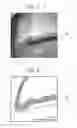 Fig. 03 - Negative electrode active material, and negative electrode and lithium ion secondary battery using the negative electrode active material